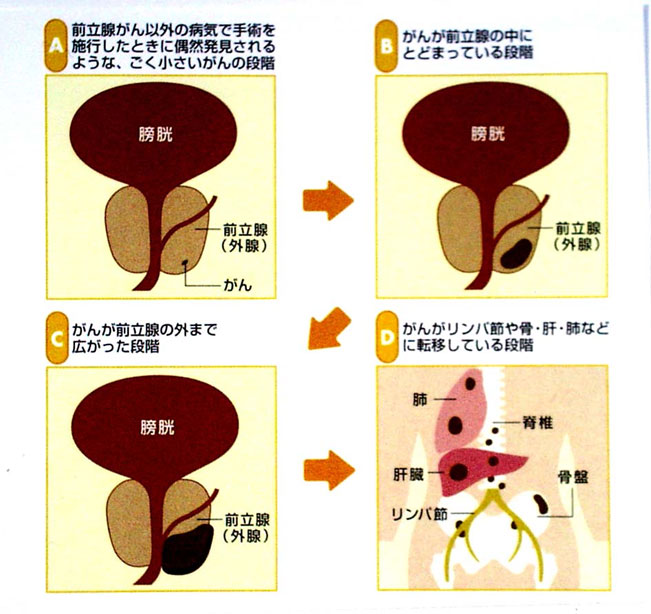 泌尿器科 高知医療センター