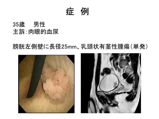 泌尿器科  高知医療センター