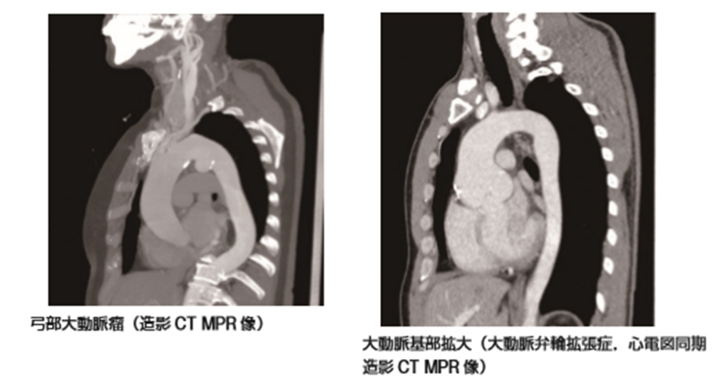 スクリーニングの仕組み